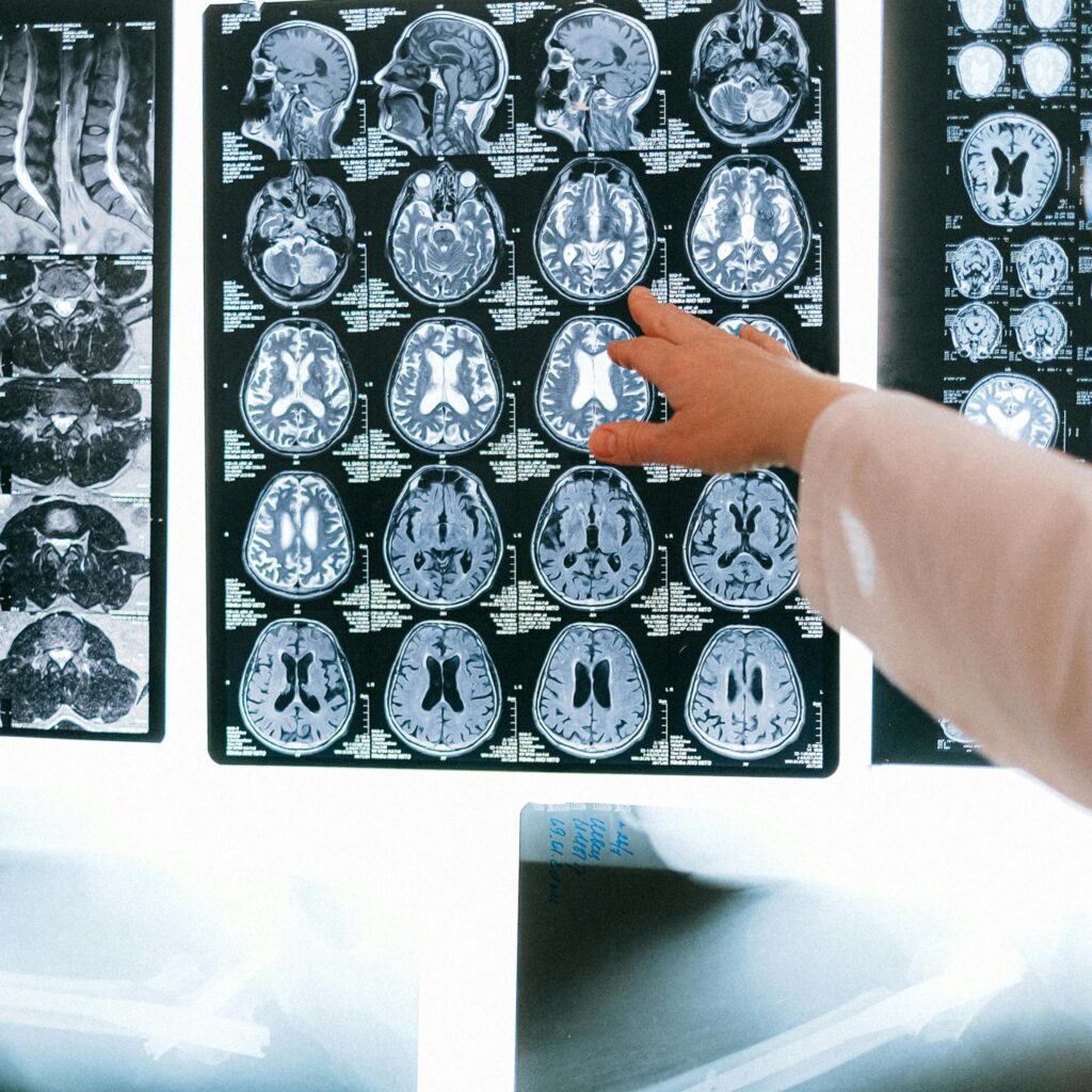Radiologist pointing at brain MRI scans showing detailed medical examination.