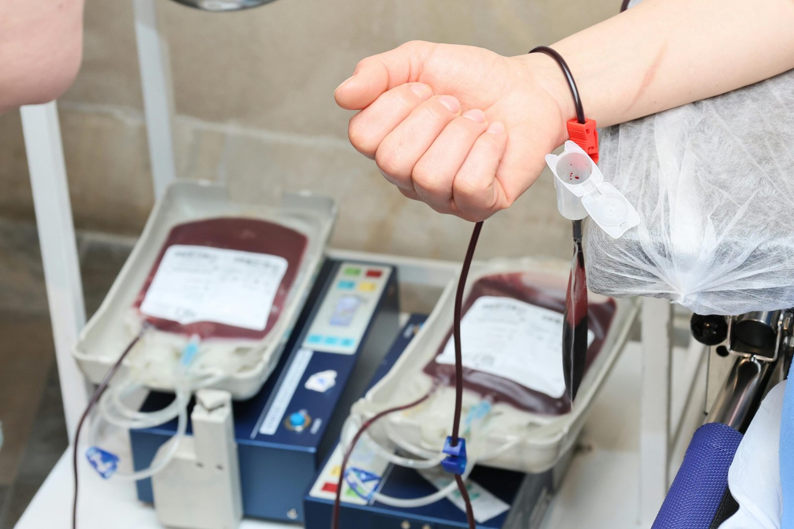Close-up of blood donation process showing a donor's arm and blood bags in a clinic.