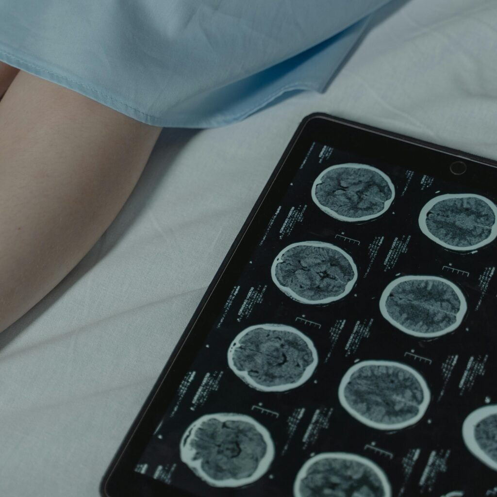 Close-up of brain CT scan display on tablet beside patient's legs in a hospital room.