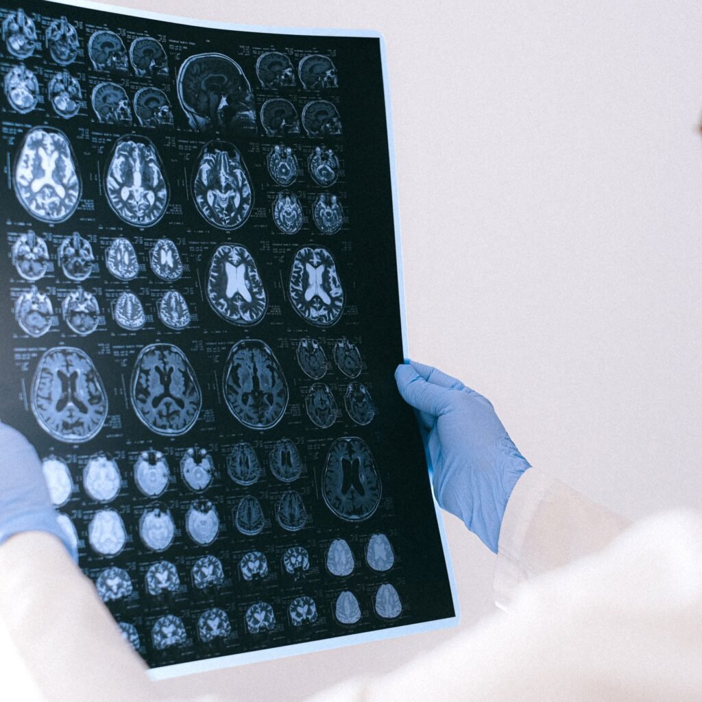 A medical professional reviewing MRI brain scans in a clinical setting, highlighting healthcare technology.