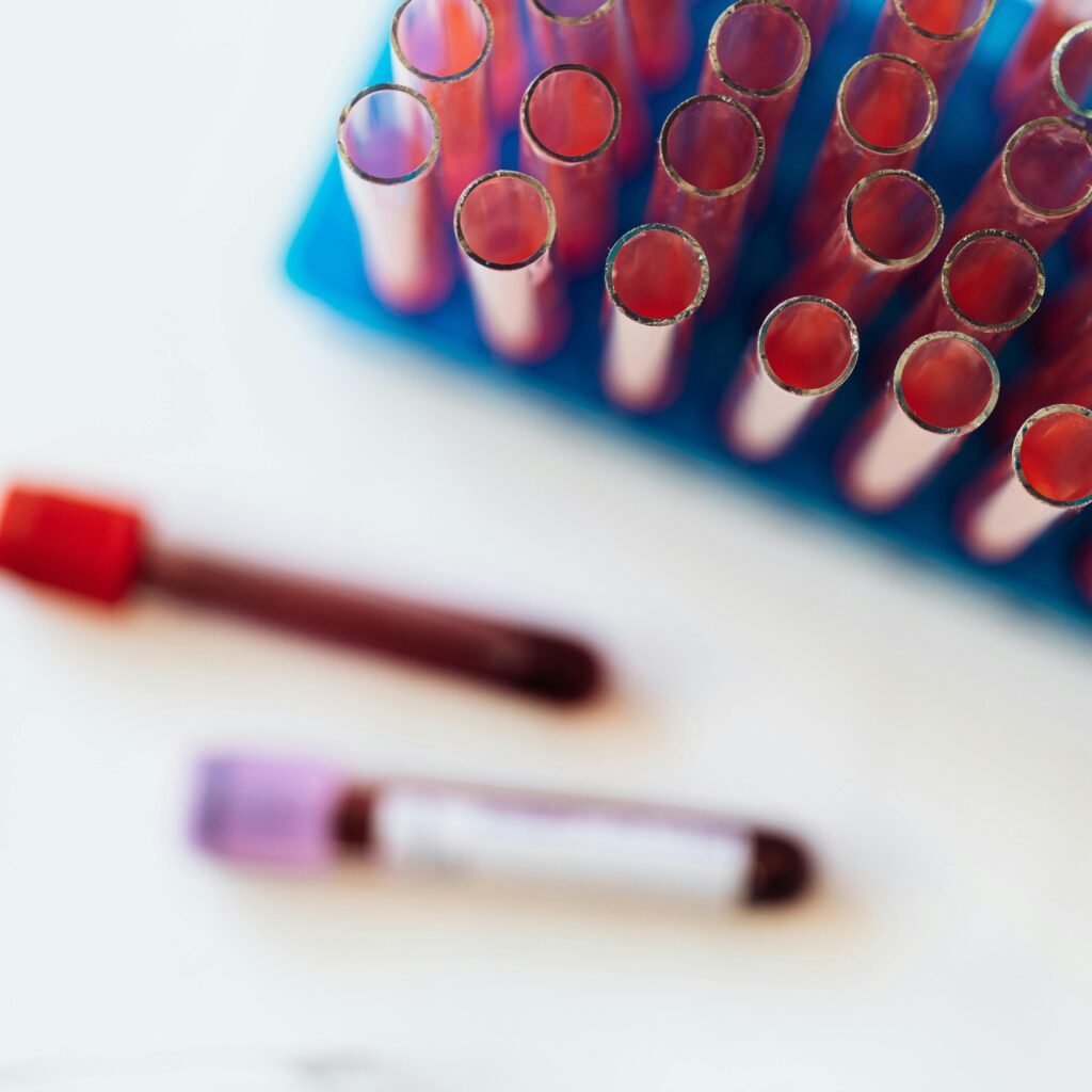 Top view of glass covered tubes arranged on table near plastic stand with tubes placed on row in modern laboratory