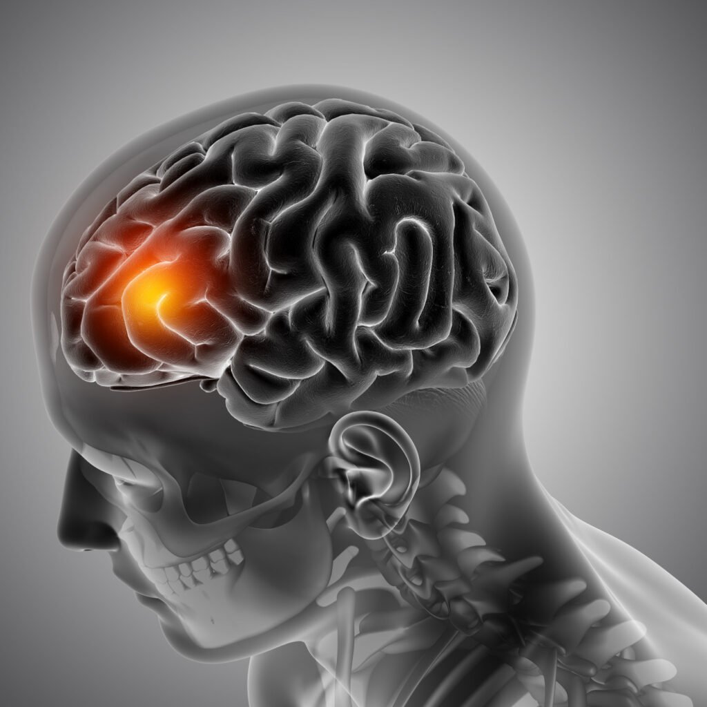 Illustration of BPM31510 mitochondrial therapy combined with radiation and temozolomide for newly diagnosed glioblastoma following encouraging Phase 2 survival results presented at ASCO 2026.