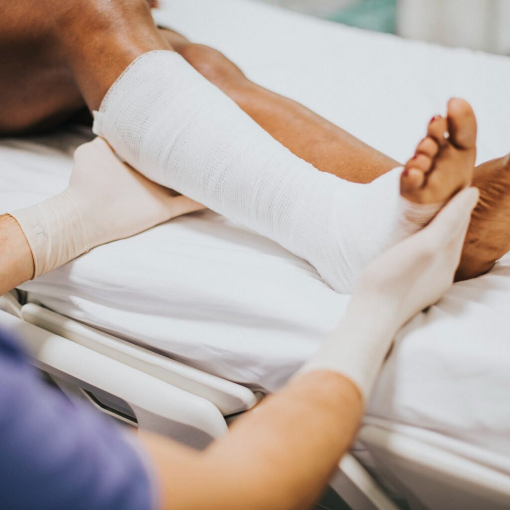 Affinity placental allograft improves wound healing in randomized clinical trial for complex venous leg ulcers