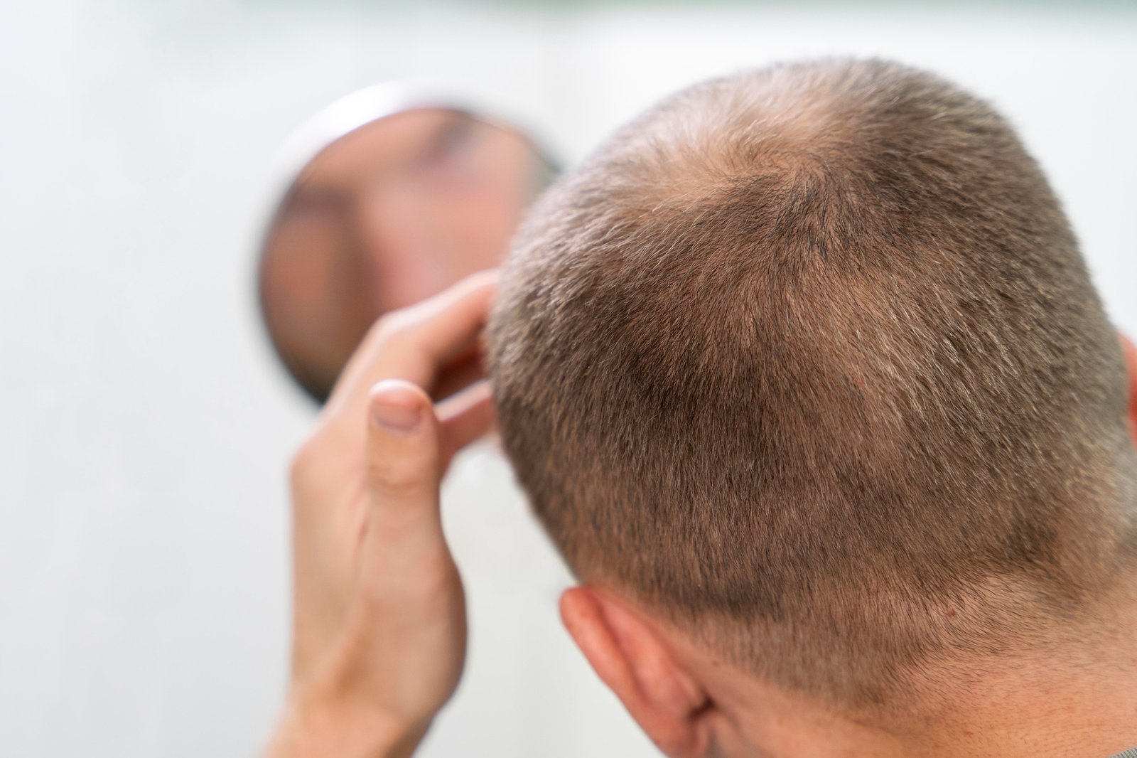 Veradermics presents Phase 2/3 Study 302 subgroup analysis showing VDPHL01 extended-release oral minoxidil efficacy and safety across age groups in men with pattern hair loss at the 2026 AAD Innovation Academy.