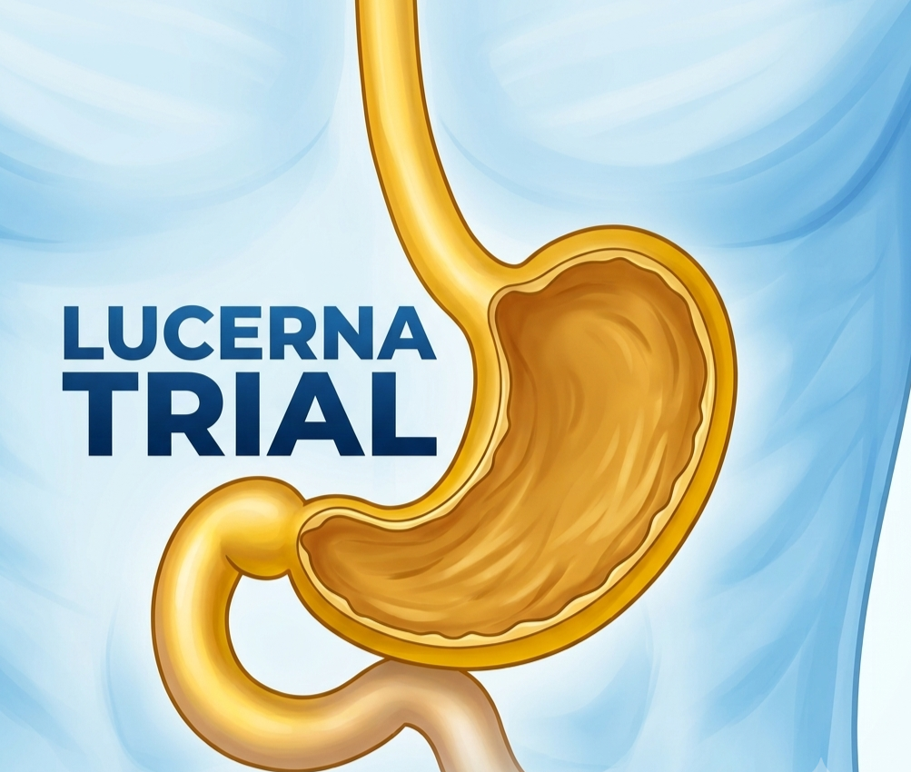 Illustration of the Phase III LUCERNA trial evaluating zolbetuximab plus pembrolizumab and chemotherapy in patients with CLDN18.2-positive, HER2-negative, PD-L1-positive advanced gastric and gastroesophageal junction cancer.