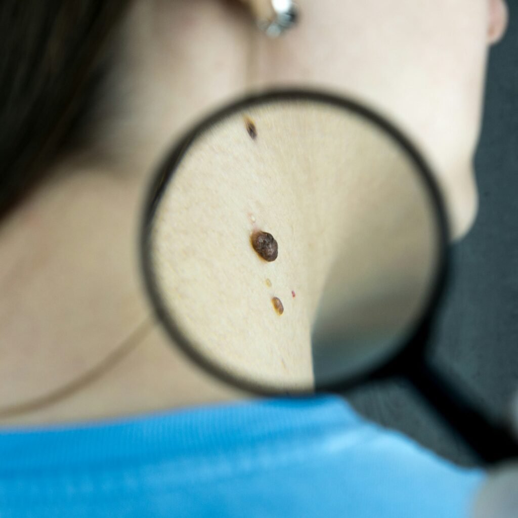 Evaxion personalized cancer vaccine EVX-01 Phase 2 advanced melanoma three-year clinical trial data presented at ESMO 2026.