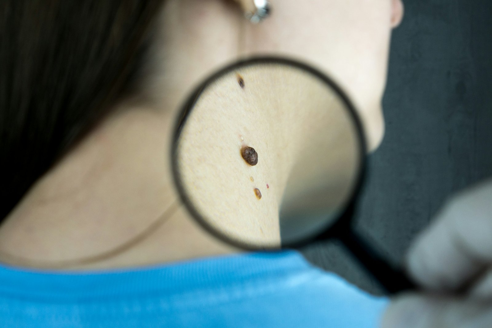 Evaxion personalized cancer vaccine EVX-01 Phase 2 advanced melanoma three-year clinical trial data presented at ESMO 2026.