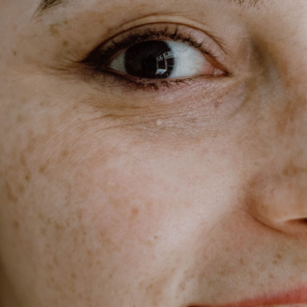 Intimate close-up portrait capturing the detailed freckles and vibrant eye of a woman in İstanbul.