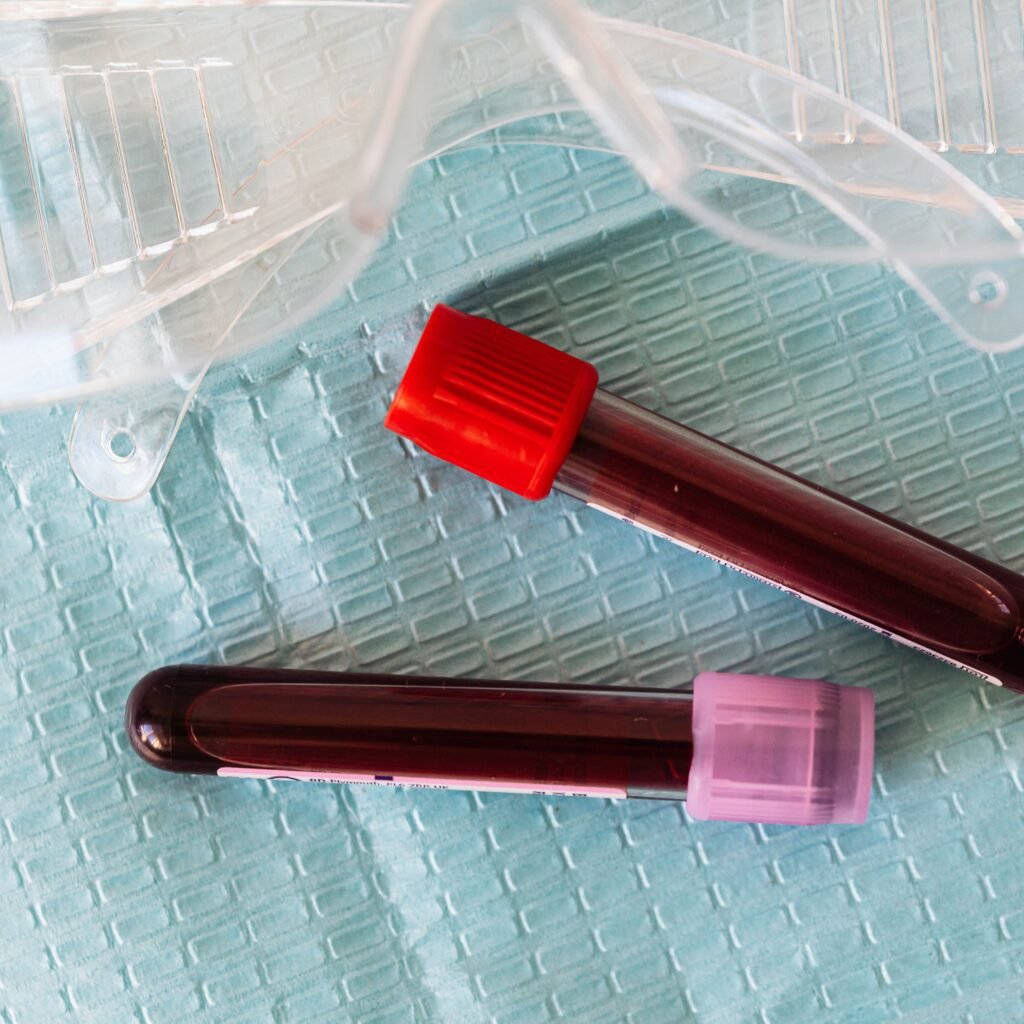 Illustration of CAD-1005 12-lipoxygenase inhibitor reducing thrombotic events in patients with heparin-induced thrombocytopenia presented at ISTH 2026.