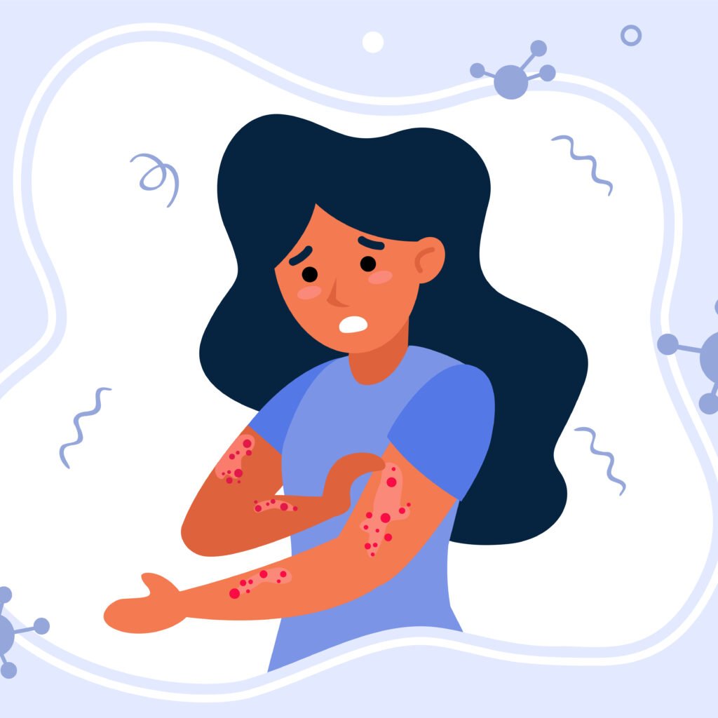 Illustration of PVX108 peptide immunotherapy for peanut allergy after receiving US FDA Fast Track designation, highlighting immune tolerance and ongoing Phase 2 clinical development.