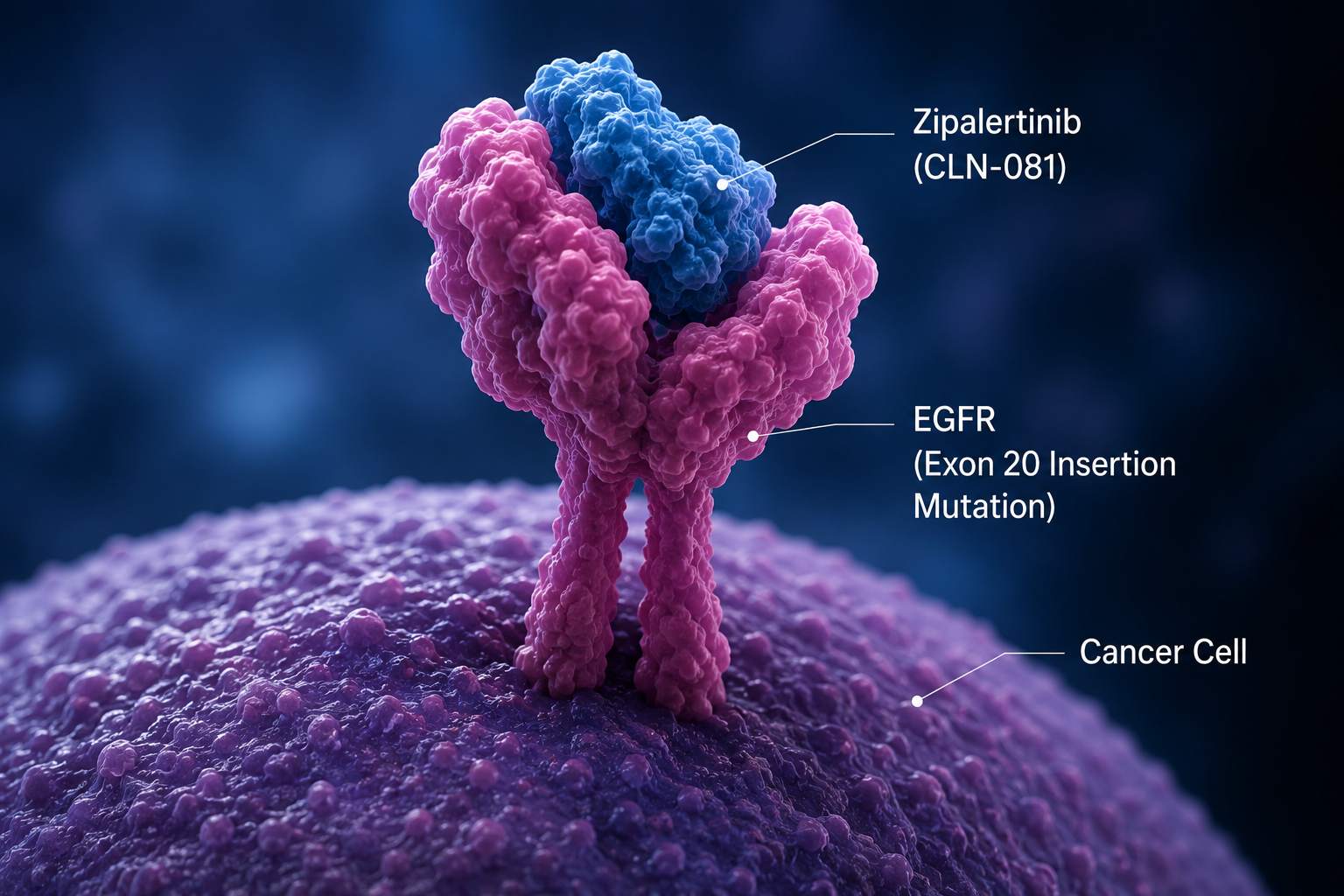 Zipalertinib plus chemotherapy meets progression-free survival endpoint in Phase 3 REZILIENT3 trial for EGFR exon 20 insertion NSCLC
