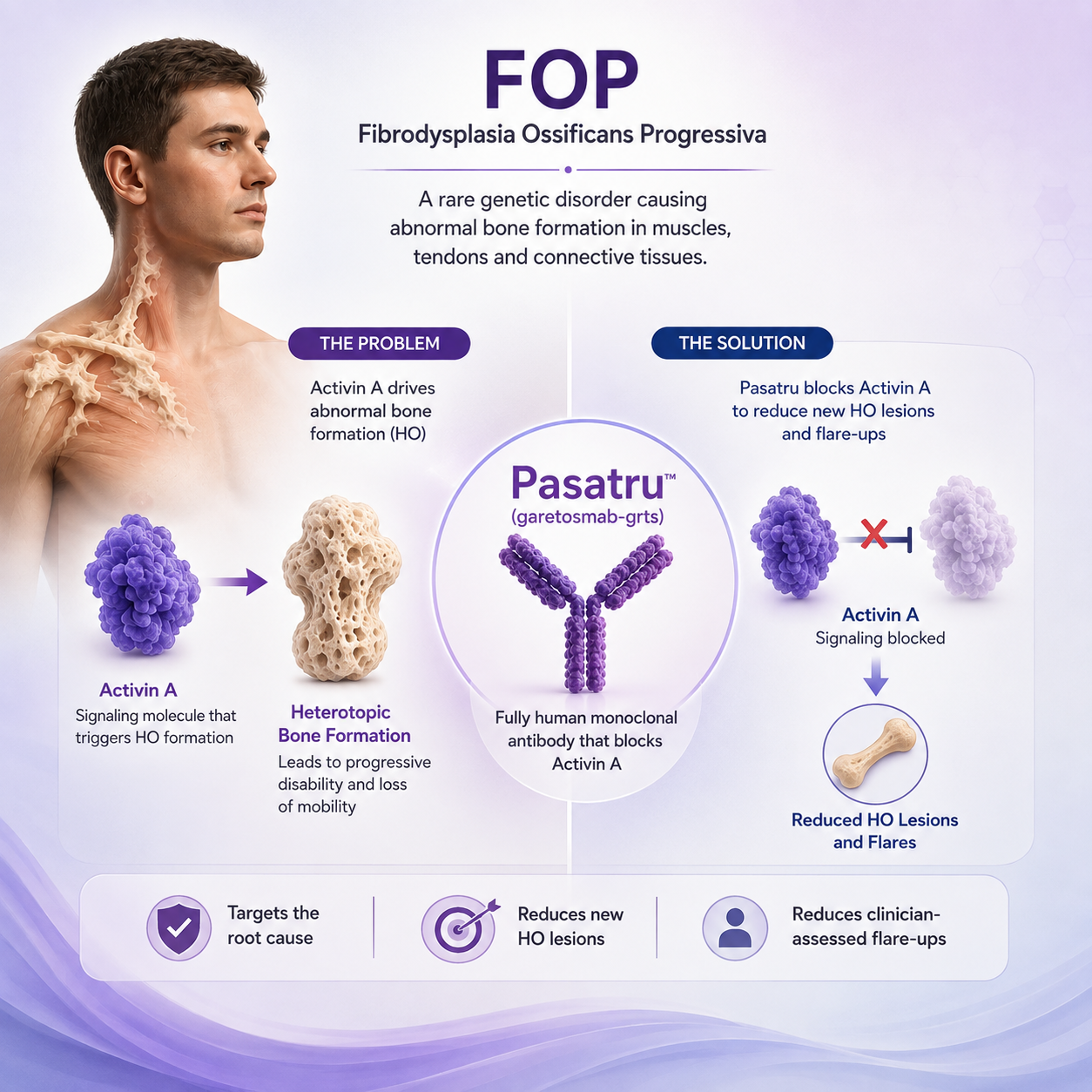 Pasatru garetosmab FDA approval for fibrodysplasia ossificans progressiva