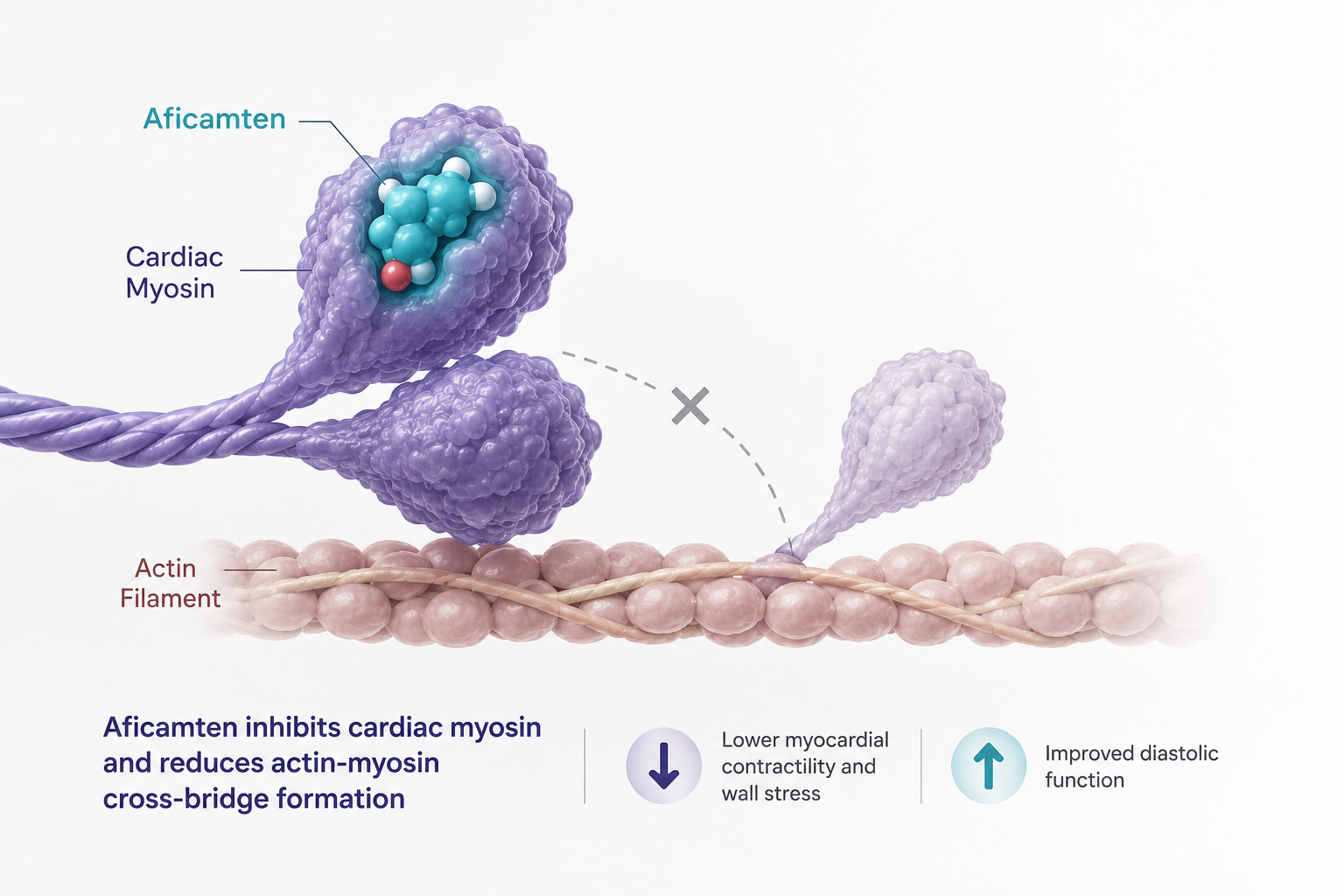 Aficamten improves exercise capacity and health status in nonobstructive hypertrophic cardiomyopathy