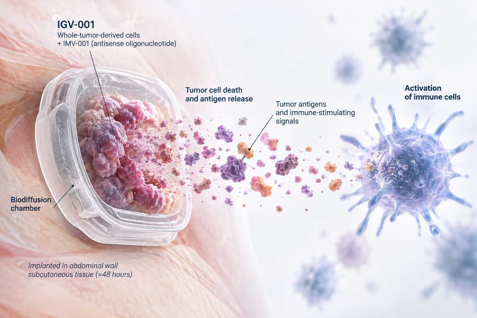 Imvax IGV-001 personalized immunotherapy for unmethylated MGMT glioblastoma