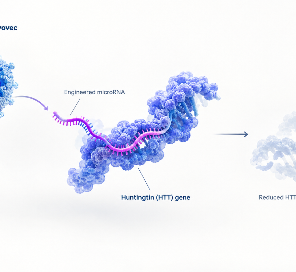 uniQure AMT-130 gene therapy for Huntington's disease