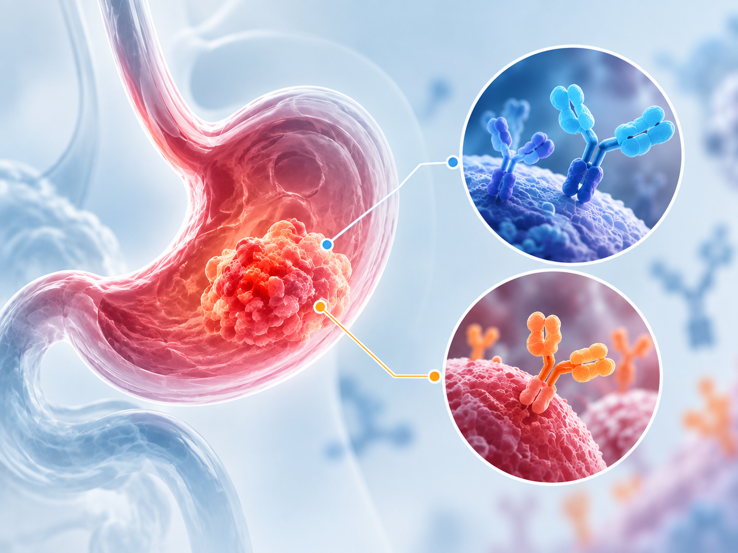 Evorpacept CD47 blockade with trastuzumab-based therapy in HER2-positive gastric cancer