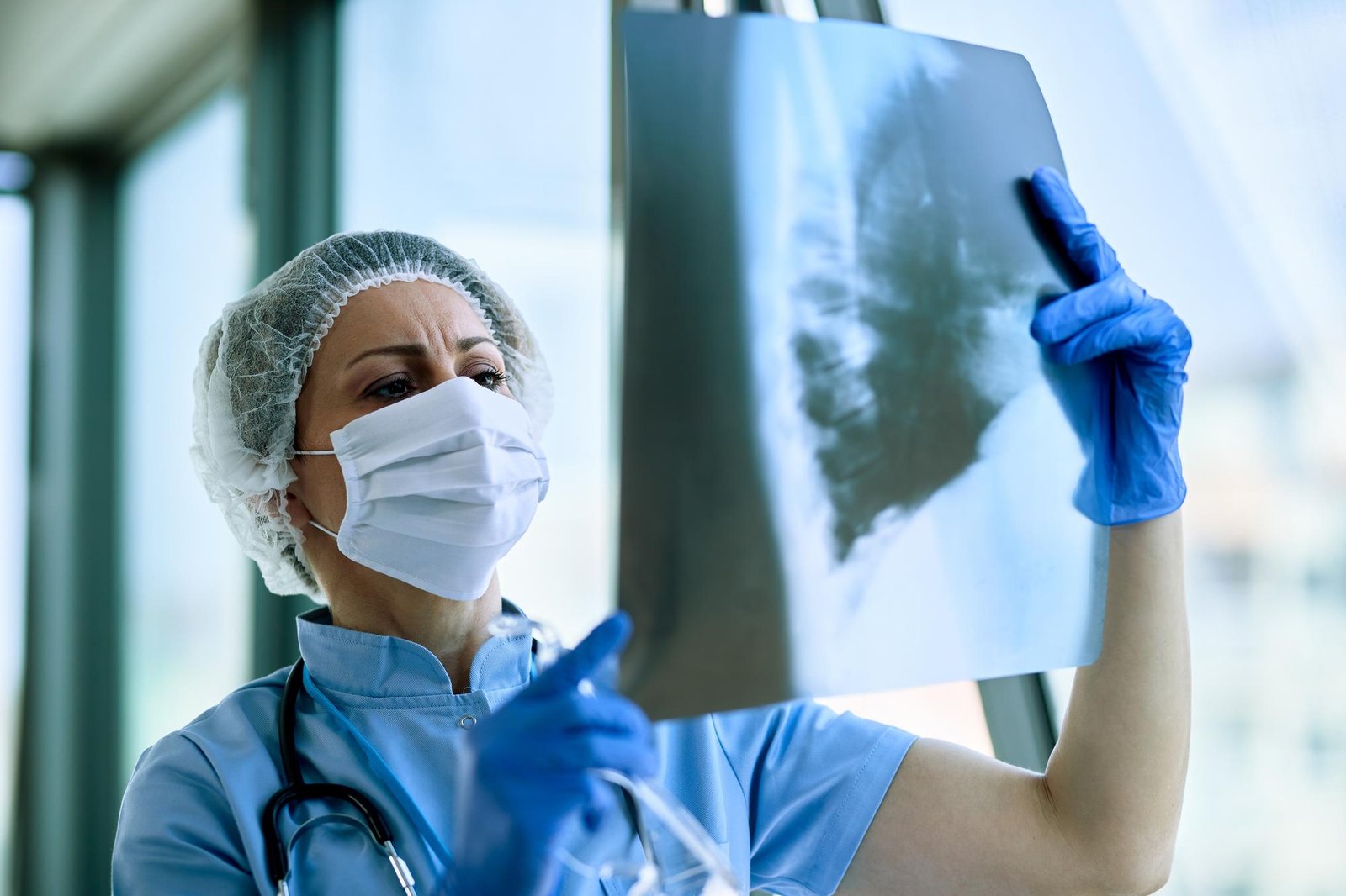 Fexlamose inhaled therapy targeting pathological airway mucus in patients with COPD