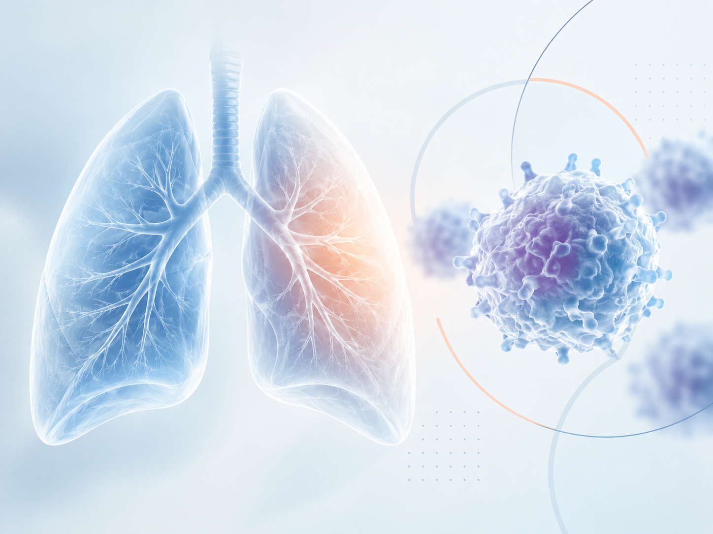 Lifileucel tumor-infiltrating lymphocyte therapy and biomarker-guided treatment strategy for metastatic non-small-cell lung cancer