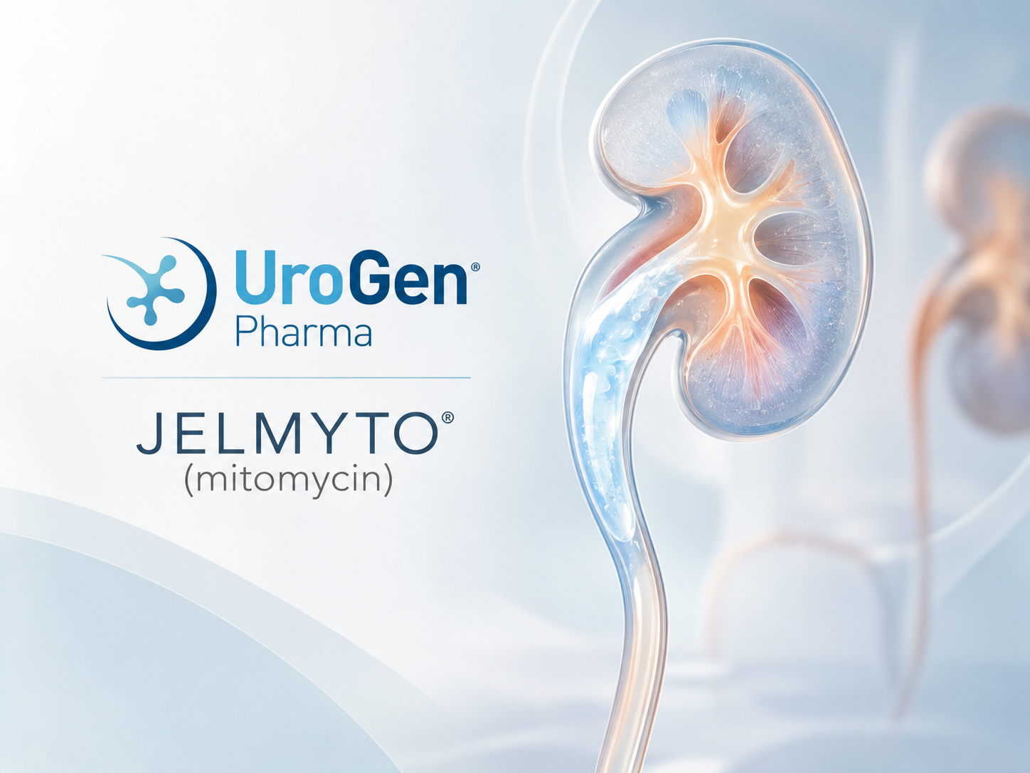JELMYTO mitomycin reverse thermal gel treatment for low-grade upper tract urothelial carcinoma showing prolonged local chemotherapy delivery.