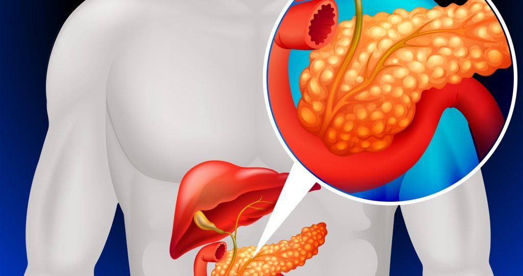 Illustration of daraxonrasib, an oral RAS(ON) inhibitor, following FDA acceptance of its NDA for previously treated metastatic pancreatic ductal adenocarcinoma (PDAC).