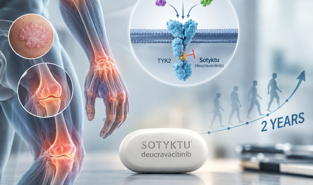 Sotyktu deucravacitinib TYK2 inhibitor showing durable efficacy in psoriatic arthritis through two years