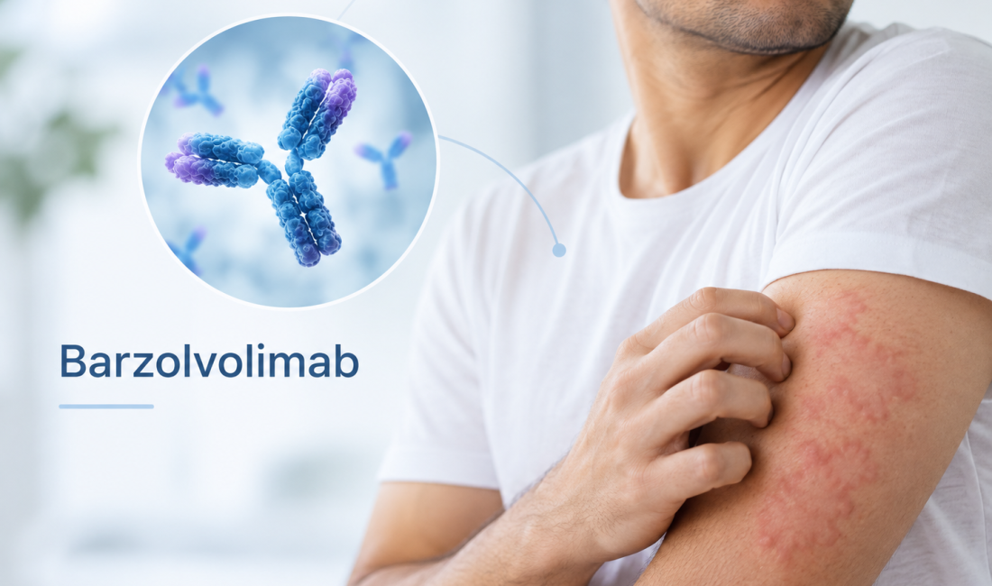 Barzolvolimab Phase 3 clinical trial results in chronic spontaneous urticaria