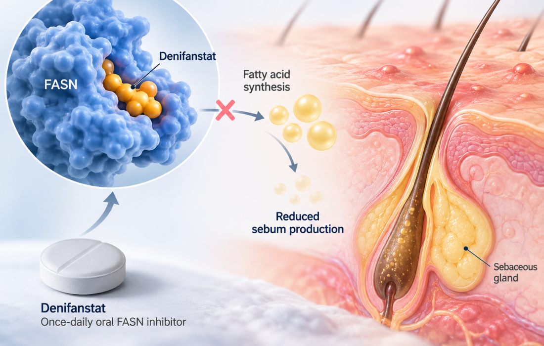 Denifanstat 52-week Phase 3 results in moderate to severe acne vulgaris