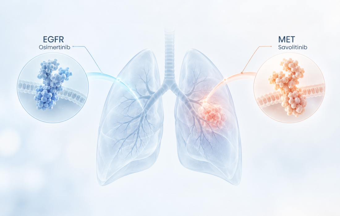 Illustration of dual EGFR and MET inhibition with osimertinib and savolitinib in EGFR-mutated, MET-overexpressing non-small cell lung cancer
