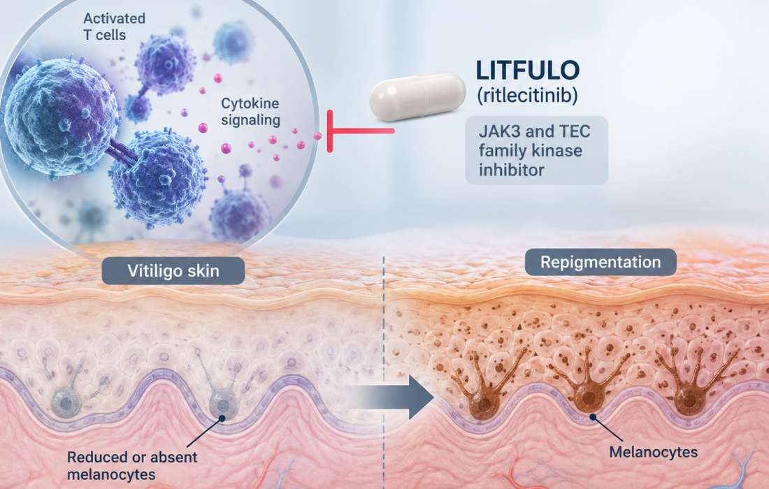 LITFULO ritlecitinib Phase 3 TRANQUILLO trials improve facial and total-body repigmentation in nonsegmental vitiligo