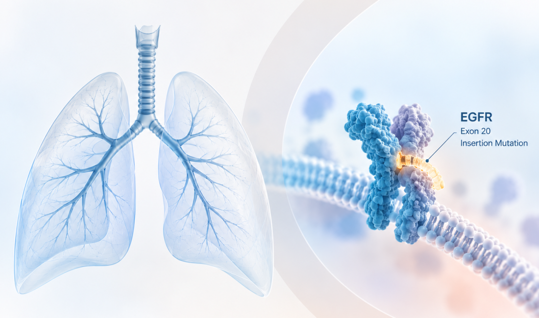 Zipalertinib plus chemotherapy for first-line EGFR exon 20 insertion-mutated NSCLC