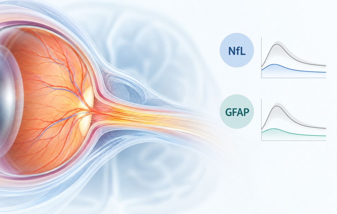 Illustration of the optic nerve and retinal nerve fibers highlighting plasma NfL and GFAP biomarker findings from Oculis's Phase 2 ACUITY trial of privosegtor in optic neuritis.