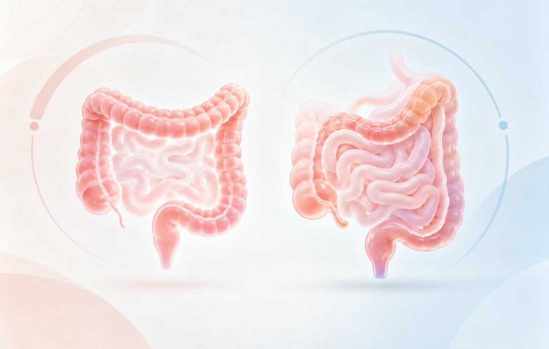 Lilly’s Omvoh (mirikizumab) achieves composite disease control in ulcerative colitis and corticosteroid-free deep remission in Crohn’s disease.