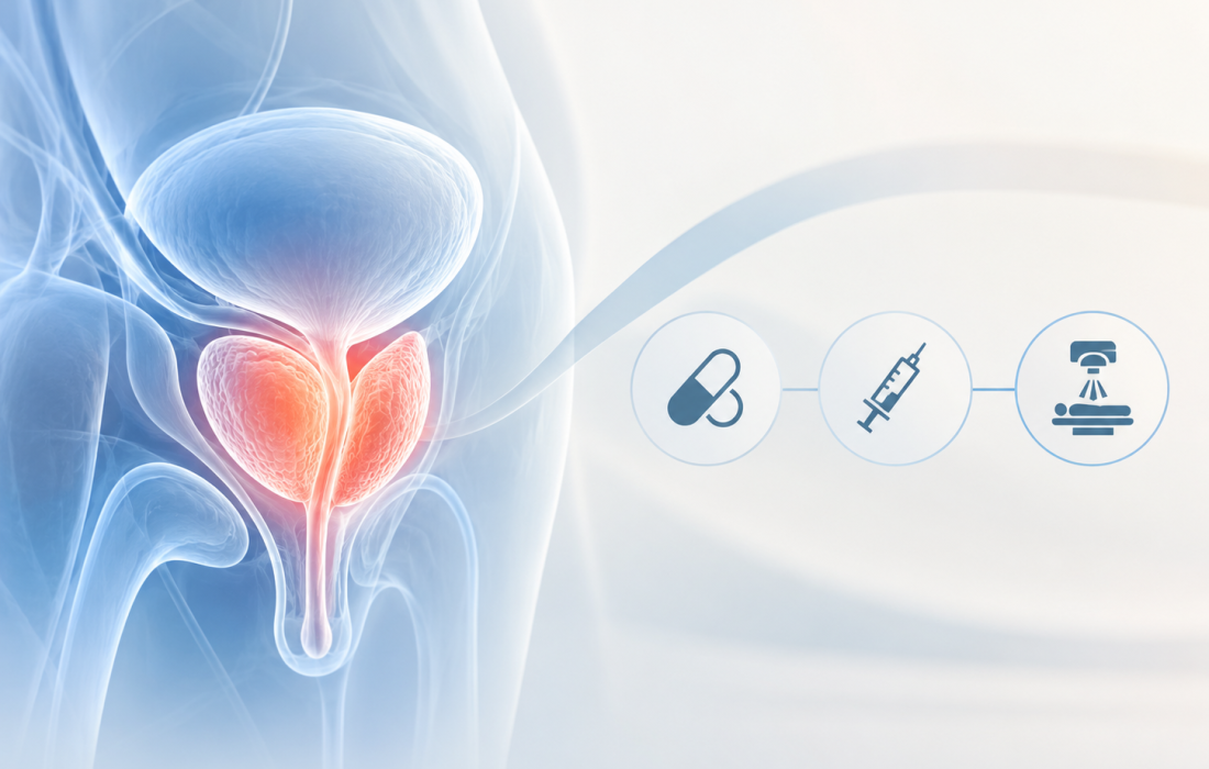 Medical illustration representing darolutamide treatment with androgen deprivation therapy and radiotherapy for high-risk prostate cancer.