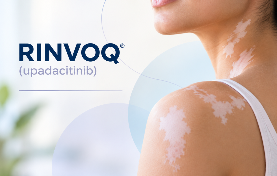 RINVOQ upadacitinib continued repigmentation in non-segmental vitiligo through Week 76
