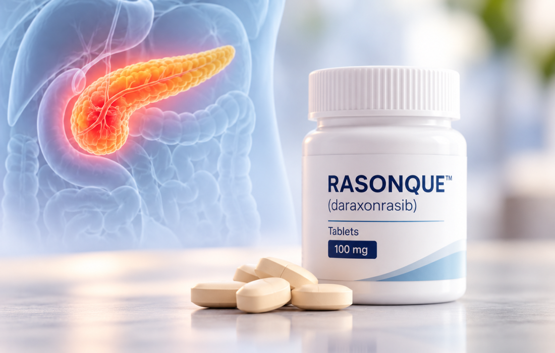 Illustration of daraxonrasib RASONQUE and RAS-targeted treatment for metastatic pancreatic cancer following a positive CHMP opinion