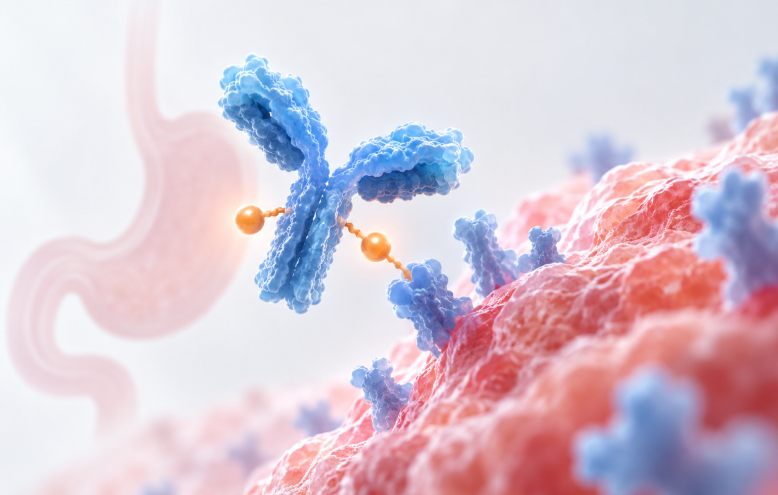 Scientific illustration of a CLDN18.2-targeted antibody-drug conjugate delivering a cytotoxic payload to gastric cancer cells