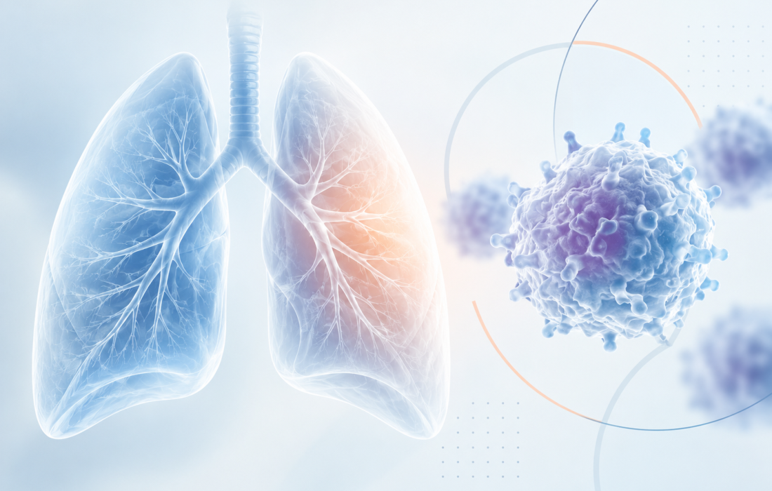 Lifileucel tumor-infiltrating lymphocyte therapy and biomarker-guided treatment strategy for metastatic non-small-cell lung cancer