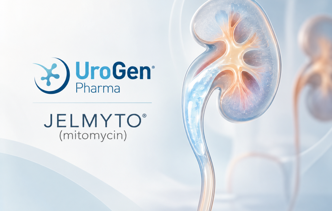 JELMYTO mitomycin reverse thermal gel treatment for low-grade upper tract urothelial carcinoma showing prolonged local chemotherapy delivery.
