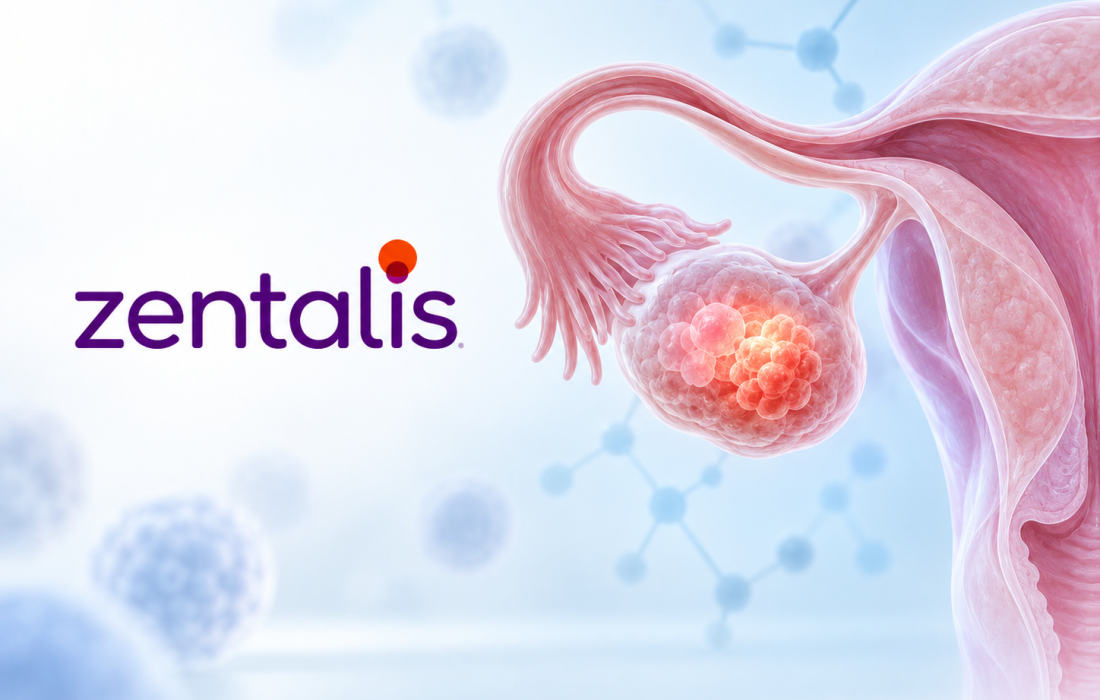 Zentalis Pharmaceuticals’ investigational WEE1 inhibitor azenosertib shows 15.8-month median overall survival in Cyclin E1-positive platinum-resistant ovarian cancer.