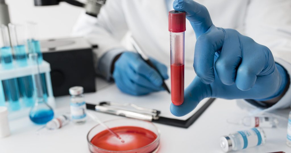 coronavirus-vaccine-composition-lab coronavirus-vaccine-composition-lab