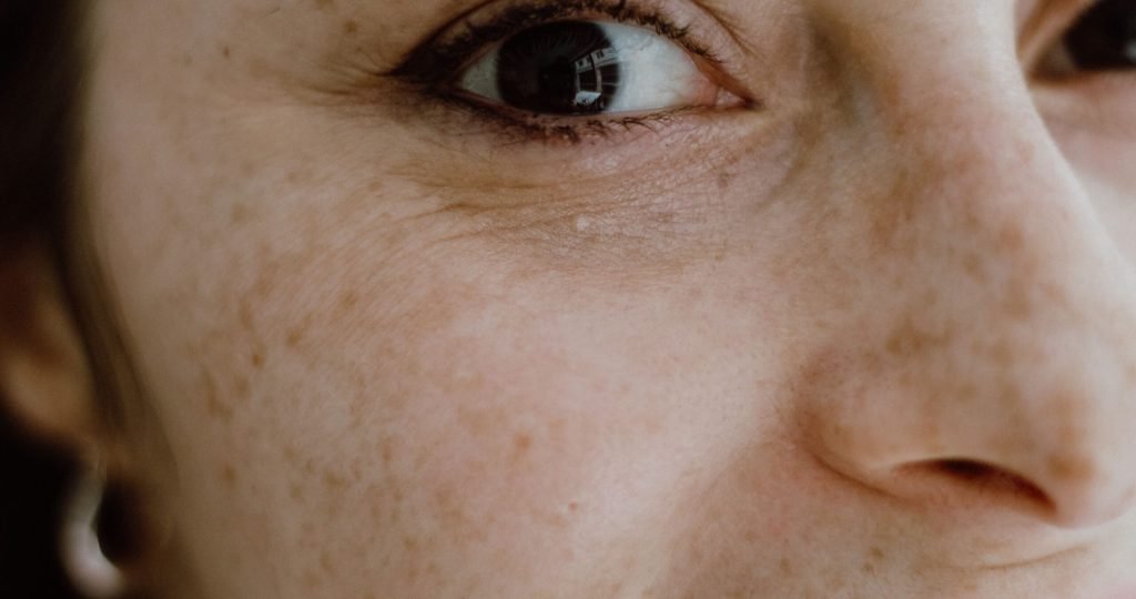 Intimate close-up portrait capturing the detailed freckles and vibrant eye of a woman in İstanbul.