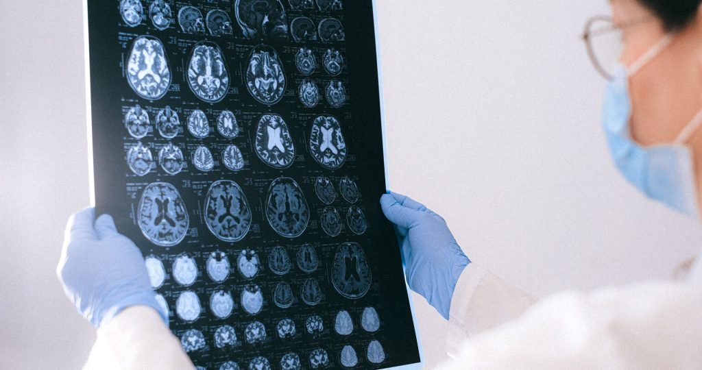 A medical professional reviewing MRI brain scans in a clinical setting, highlighting healthcare technology.