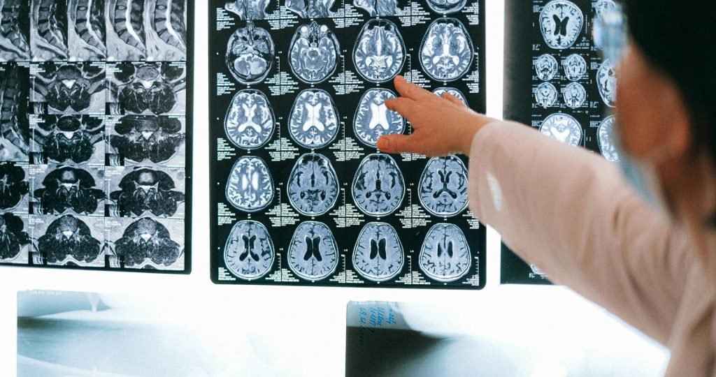 Radiologist pointing at brain MRI scans showing detailed medical examination.
