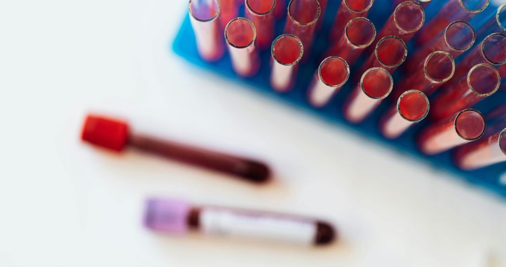 Top view of glass covered tubes arranged on table near plastic stand with tubes placed on row in modern laboratory