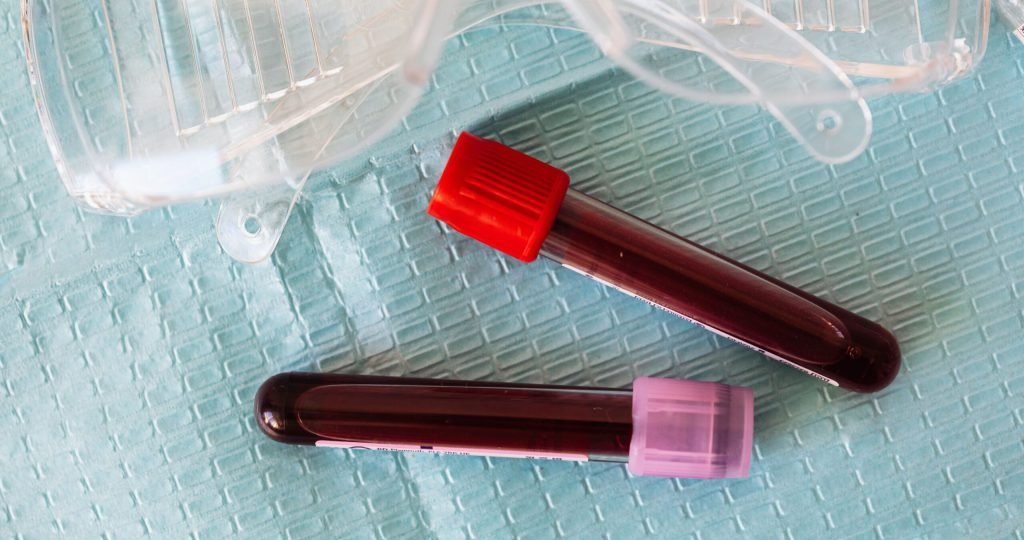 Illustration of CAD-1005 12-lipoxygenase inhibitor reducing thrombotic events in patients with heparin-induced thrombocytopenia presented at ISTH 2026.