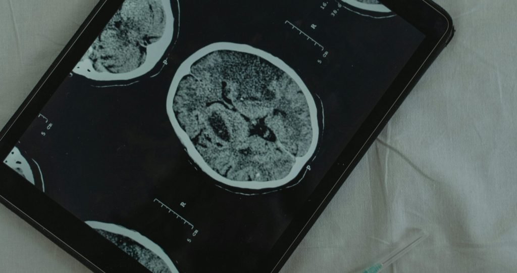 Close-up view of a brain CT scan displayed on a digital tablet with a medical needle beside it.