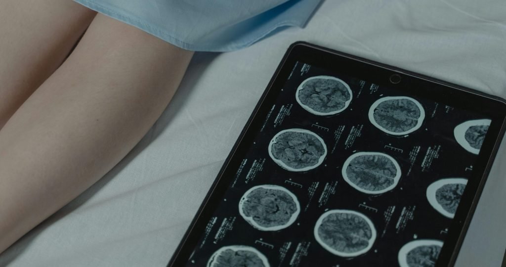 Close-up of brain CT scan display on tablet beside patient's legs in a hospital room.